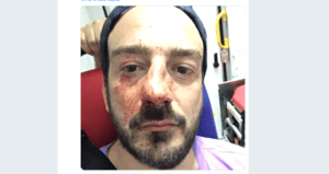 Guillaume Mélanie, président de l'association Urgence Homophobie, violemment agressé à Paris.