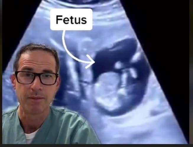 canada foetus foie mère grossesse cas rare