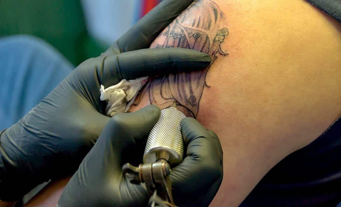 détatouage pratique comment ça se passe conseils enlever tatouage
