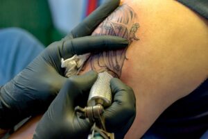 détatouage pratique comment ça se passe conseils enlever tatouage